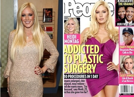 heidi montag after surgery people. Before and After People