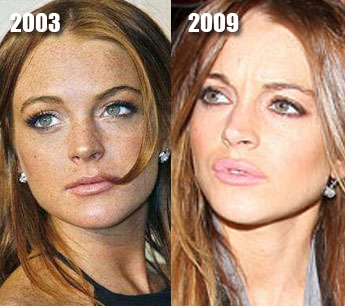 Roma Downey Plastic Surgery on Lindsay Lohan Plastic Surgery Before After Pictures 2012