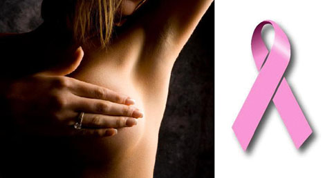 breast cancer1