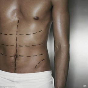 plastic-surgery-for-men-290x290