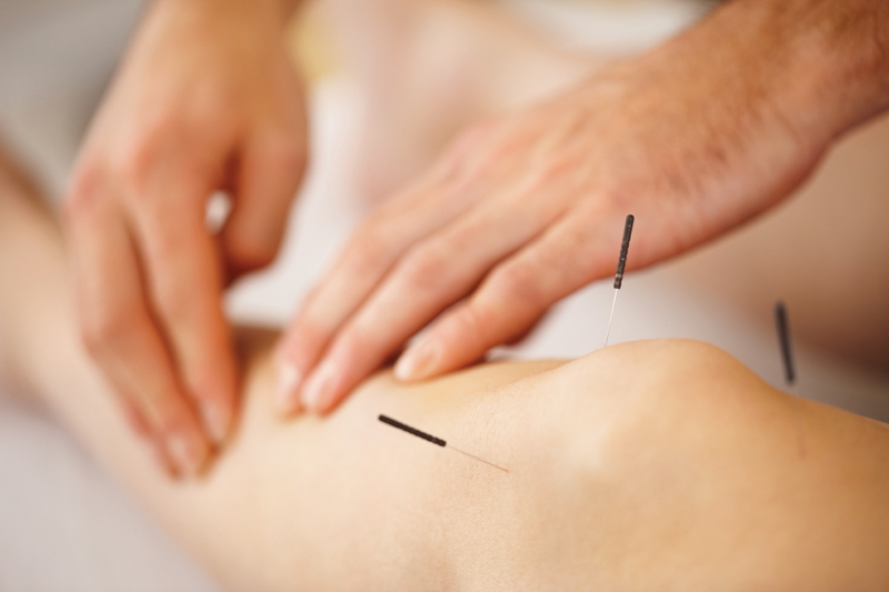 j-c-lincoln-health-acupuncture