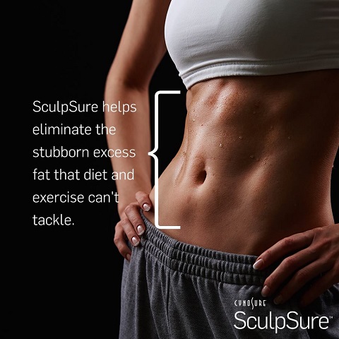 sculpsure.jpg